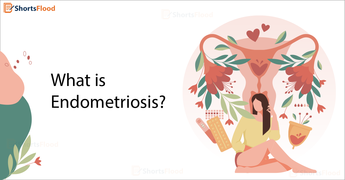 What is Endometriosis? - ShortsFlood